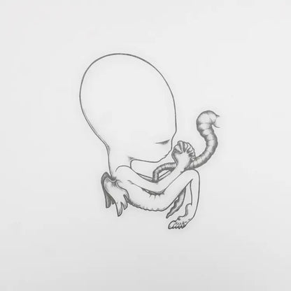 Sigur Rós - Ágætis byrjun (Rough Trade Box 4LPs Deluxe)